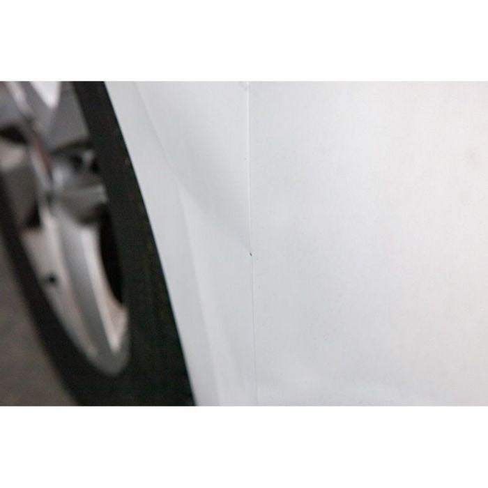 Quixx Dent Removal Kit