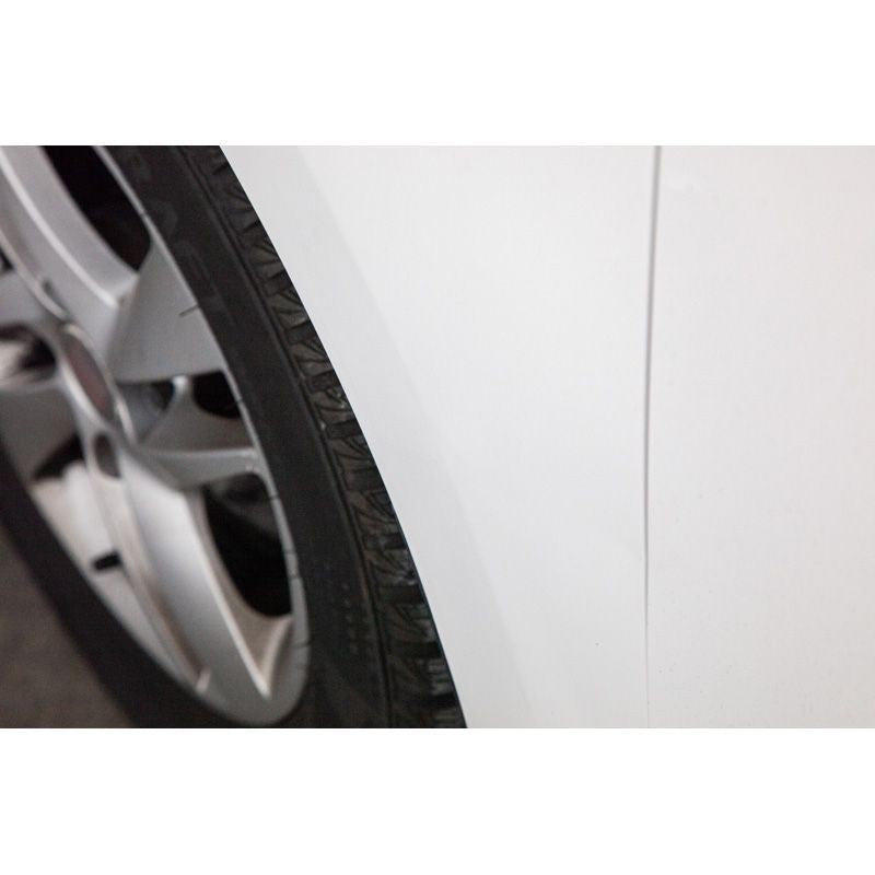 Quixx Dent Removal Kit